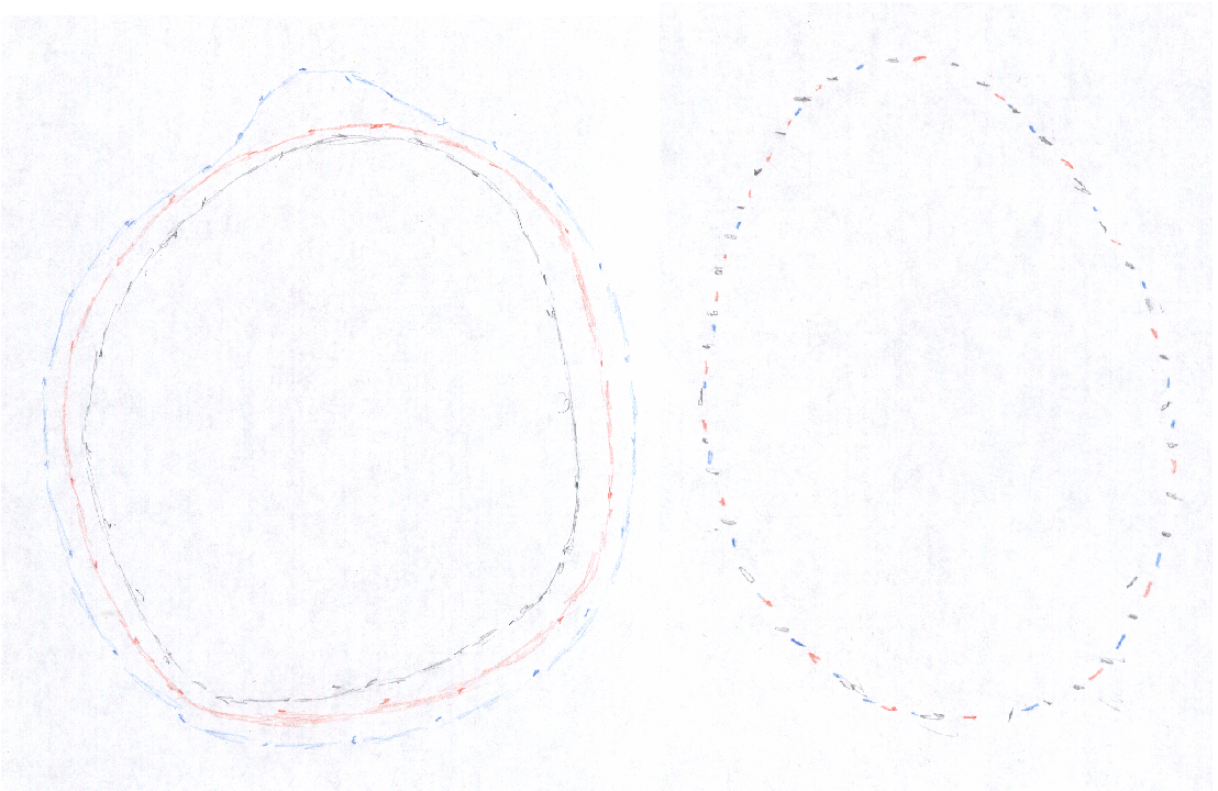 cercles